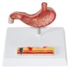 Comparative Human Stomach Anatomical Model with Tissue Contrast Structure, Detailed Gastric Organ Display Kit for Biology Classroom Teaching & Visual Learning