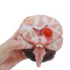 Human Brain Anatomical Model - Brain Pathological Structure Model, Cerebral Hemorrhage, Cerebral Arteriovenous Malformation Pathological for Teaching Research Demonstration