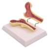 Human Osteoporosis Model - Human Leg Bone Anatomy Model, Anatomy Femoral Internal Structure - for Teaching Students, Study Display, Teaching Demonstration