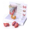Human Thyroid Lesion Model, Can Be Disassembled Into 5 Parts