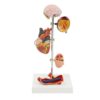 Hypertension Model - Diseased Brain, Artery, Eye, Heart, Kidney, Anatomical Model, Removable 5 Parts Human Organ - for Anatomy Demonstration Educational Tool