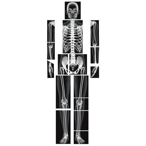Lineshading 16 Pieces Human x Rays Bones Pretend x Rays for Kids Human Bones Body Educational Science Kit Display Play Table(Black and White)