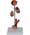 MOWFXUA Diabetes Organ Model - Diabetes Medical Anatomical Model - Removable Human Anatomical Model Scientific Human Anatomy Models - for Training Aid