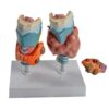 Pathological Thyroid Model,Design of Removable Components