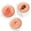 Skin Lesion Model Set for Dermatology Education Training, 3 Pcs