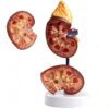 Detachable 2-Part Life Size Human Kidney Anatomy Model with Digital Signs