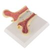 Human Femur Comparative Anatomical Model with Stable Base, Normal & Diverse Bone Structure Displays for Science Classroom Teaching and Medical Demonstration