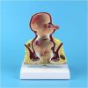IVQAPP Pathological model of hemorrhoids Anorectal Teaching anatomy model - Anatomical model of human organs Model of anorectal pathology - Doctor-patient model of communication and