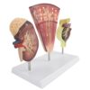 Kidney Anatomy Model - Accurate Nephron and Glomerulus Structure with Clear Texture, Detachable Parts for Teaching and Demonstration, Educational Tool