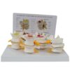 QINGHEDZSW Human Spine Model with English Back Card, 4-Stage Lumbar Vertebrae Model, Display Herniated Disc, Bone & Disc Degeneration & Advanced Osteoporosis, for Learning and Education