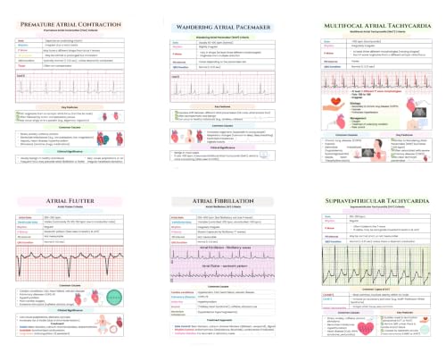 TINAZG QWIE EKG ECG Atrial Arrhythmia Posters Set of 6, Cardiac Rhythm Strip Study Guide Wall Charts for Nursing Students, Atrial Fibrillation SVT PAC Medical Classroom Decor, Unframed