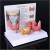 WEDBXNVXahrs Thyroid Gland Anatomical Model 3:1 Magnification with Pathological Nodules for Medical Education Human Body Endocrine Study Display Teaching Tool