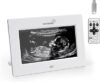 Grownsy Sonogram Digital Picture Frame,7‑Inch USB Photo Keepsake