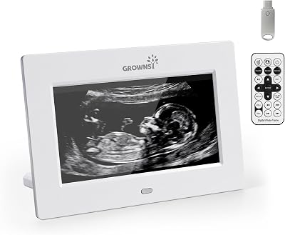 Grownsy Sonogram Digital Picture Frame,7‑Inch USB Photo Keepsake