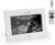Grownsy Sonogram Digital Picture Frame,7‑Inch USB Photo Keepsake