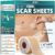 Silicone Scar Tape (60″ x 1.6″ Roll)