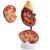 Detachable 2-Part Life Size Human Kidney Anatomy Model with Digital Signs