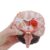 Human Brain Anatomical Model – Brain Pathological Structure Model, Cerebral Hemorrhage, Cerebral Arteriovenous Malformation Pathological for Teaching Research Demonstration