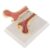 Human Femur Comparative Anatomical Model with Stable Base, Normal & Diverse Bone Structure Displays for Science Classroom Teaching and Medical Demonstration