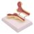 Human Osteoporosis Model – Human Leg Bone Anatomy Model, Anatomy Femoral Internal Structure – for Teaching Students, Study Display, Teaching Demonstration