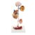 Hypertension Model – Diseased Brain, Artery, Eye, Heart, Kidney, Anatomical Model, Removable 5 Parts Human Organ – for Anatomy Demonstration Educational Tool