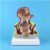 IVQAPP Pathological model of hemorrhoids Anorectal Teaching anatomy model – Anatomical model of human organs Model of anorectal pathology – Doctor-patient model of communication and