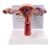 Pathological Uterus and Ovary Model Human Anatomy PVC 24x16cm