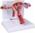 Pathological Uterus Ovary Model Human Female Reproductive Anatomy