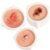 Skin Lesion Model Set for Dermatology Education Training, 3 Pcs